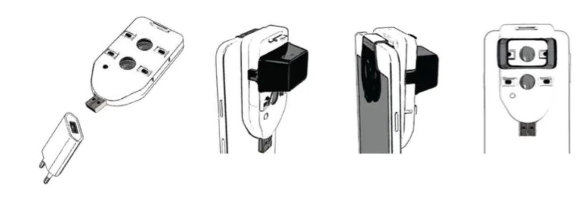 TriSeven Neviscope - Dermatoscopio telefonico con obiettivo/luce LED, 100 x fotocamera con clip universale per la maggior parte dei telefoni iPhone/Android per bambini e adulti